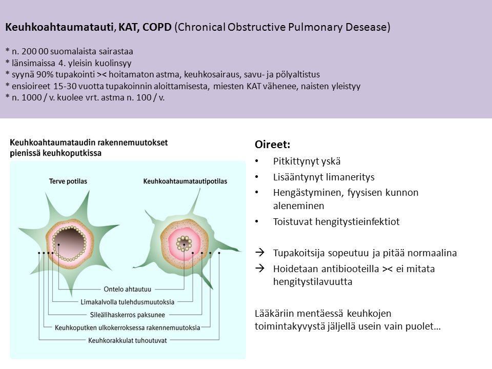 Keuhkoahtaumatauti, KAT, COPD (Chronical Obstructive Pulmonary Desease) * n.